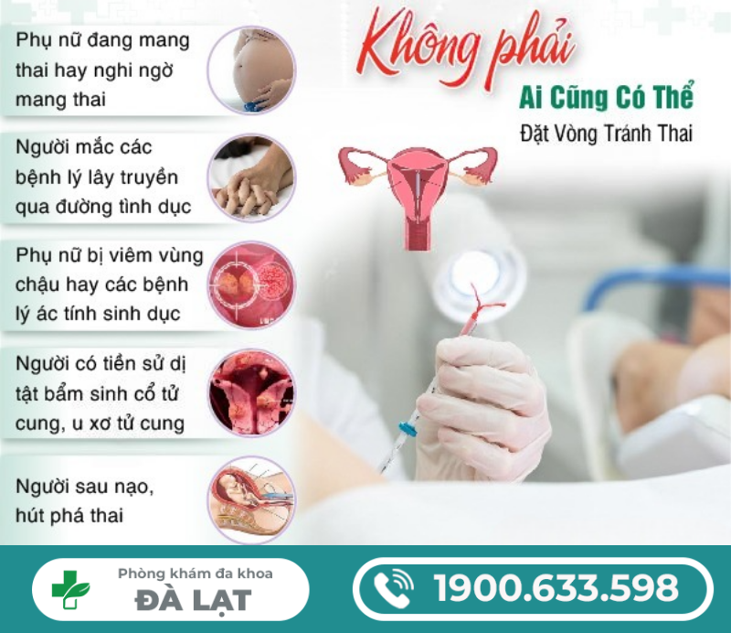 Hình ảnh minh họa